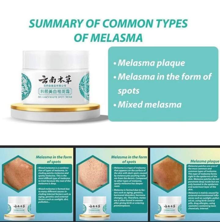 Japanese Melasma Cream - MARRIABEE